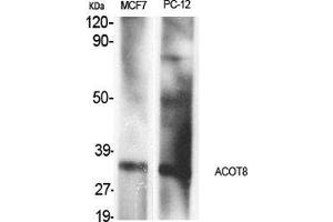 Western Blot (WB) analysis of specific cells using ACOT8 Polyclonal Antibody. (ACOT8 antibody  (Internal Region))