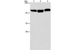 Western Blot analysis of Hela, NIH/3T3 and Raji cell using DNM2 Polyclonal Antibody at dilution of 1:400 (DNM2 antibody)