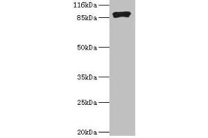 Western blot All lanes: RRM1 antibody at 2 μg/mL + Hela whole cell lysate Secondary Goat polyclonal to rabbit IgG at 1/10000 dilution Predicted band size: 91 kDa Observed band size: 91 kDa (RRM1 antibody  (AA 1-792))