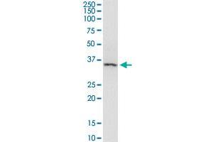 Western Blotting (WB) image for anti-Arrestin, beta 2 (ARRB2) (AA 300-409) antibody (ABIN513515)