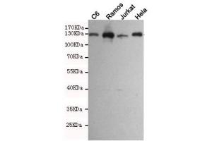 Western blot testing of rat C6 and human Ramos, Jurkat and HeLa cell lysates using JAK1 antibody at 1:1000.