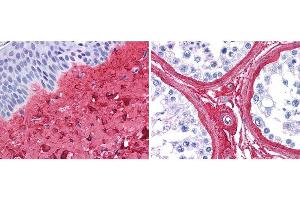 anti collagen III antibody (600-401-105 Lot 26016, 1:400, 45 min RT) showed strong staining in FFPE sections of human skin(left, dermis) with moderate to strong red staining and testis (right) where strong staining was observed within connective tissue between seminiferous tubules. (COL3 antibody)
