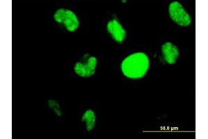 Immunofluorescence (IF) image for anti-Hypermethylated in Cancer 1 (HIC1) (AA 396-453) antibody (ABIN516435)