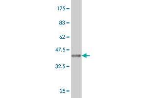 Western Blot detection against Immunogen (36. (CA7 antibody  (AA 34-125))