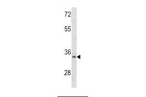 Western blot analysis of MCA1 antibody (C-term) (ABIN390679 and ABIN2840973) in 293 cell line lysates (35 μg/lane). (MCA1 antibody  (C-Term))