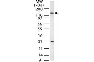 Western blot analysis of HDAC-4 in Jurkat cell lysate with HDAC4 polyclonal antibody  .
