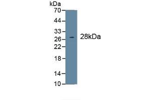 Detection of Recombinant COL1a1, Human using Monoclonal Antibody to Collagen Type I Alpha 1 (COL1a1) (COL1A1 antibody  (AA 1218-1440))