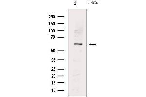 Western blot analysis of extracts from Hela cells, using PKM2(phospho-Ser37) Antibody. (PKM antibody  (pSer37))