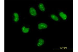 Immunofluorescence of purified MaxPab antibody to CUTC on HeLa cell. (CUTC antibody  (AA 1-273))