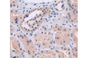 Used in DAB staining on fromalin fixed paraffin- embedded kidney tissue (BCAT2 antibody  (AA 107-392))