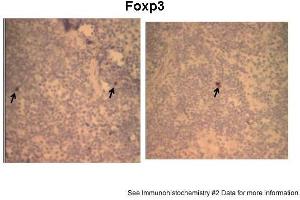 ﻿Sample Type: Mouse Spleen frozen with positive lymphocytes/ HPF (x400)Primary Dilution: 1:100Secondary Antibody: Vector Lab Goat Biotin-Conjugated Anti-Rabbit IgGSecondary Dilution: 1:100Image Submitted By: Atsushi Kawabata at Kansas State University (FOXP3 antibody  (N-Term))