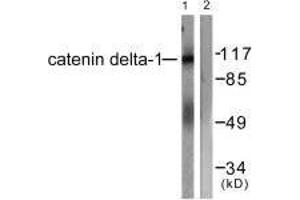 Western blot analysis of extracts from HuvEc cells, using Catenin-δ1 (Ab-228) antibody. (CTNND1 antibody  (Tyr228))