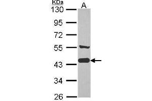 WB Image Sample (30 ug of whole cell lysate) A: JurKat 10% SDS PAGE AHA-1 antibody antibody diluted at 1:1000 (AHSA1 antibody  (Center))