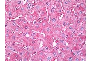 Image no. 1 for anti-Transferrin (TF) antibody (ABIN471288) (Transferrin antibody)
