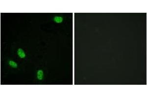 Immunofluorescence analysis of HeLa cells, using Progesterone Receptor (Phospho-Ser294) Antibody.