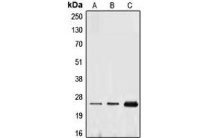 Western blot analysis of Ephrin A1 expression in THP1 (A), HUVEC (B), MCF7 (C) whole cell lysates. (Ephrin A1 antibody  (Center))