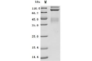 Met Proto-Oncogene (MET) (AA 25-932) (Active) protein (His-Avi Tag)