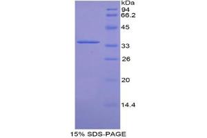 SDS-PAGE analysis of Mouse CDK4 Protein. (CDK4 Protein)