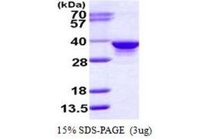 SDS-PAGE (SDS) image for Ribose 5-Phosphate Isomerase A (RPIA) (AA 1-311) protein (His tag) (ABIN667643)