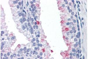 Human Prostate: Formalin-Fixed, Paraffin-Embedded (FFPE) (Rhotekin antibody  (AA 451-550))