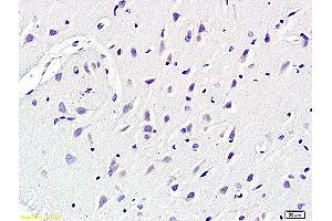 Formalin-fixed and paraffin embedded rat brain labeled with Anti KCNN4 Polyclonal Antibody, Unconjugated (ABIN719786) at 1:200 followed by conjugation to the secondary antibody and DAB staining
