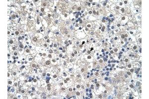 RTN2 antibody was used for immunohistochemistry at a concentration of 4-8 ug/ml to stain Hepatocytes (arrows) in Human Liver. (Reticulon 2 antibody  (N-Term))