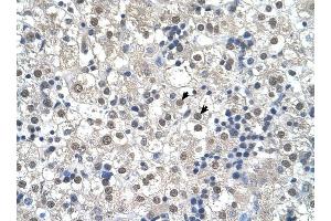 RTN2 antibody was used for immunohistochemistry at a concentration of 4-8 ug/ml to stain Hepatocytes (arrows) in Human Liver.