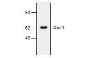 Image no. 1 for anti-Death Inducer-Obliterator 1 (DIDO1) (N-Term) antibody (ABIN127222)