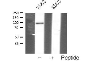 Western blot analysis of VAV1 expression in K562 whole cell lysates,The lane on the left is treated with the antigen-specific peptide. (VAV1 antibody  (N-Term))