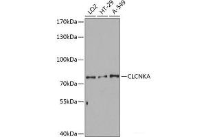 CLCNKA 抗体