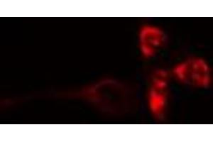 ABIN6272379 staining COLO205 by IF/ICC. (OTUB2 antibody  (Internal Region))