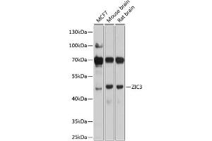 Western blot analysis of extracts of various cell lines, using ZIC3 antibody (ABIN6133228, ABIN6150444, ABIN6150446 and ABIN6225011) at 1:1000 dilution. (ZIC3 antibody  (AA 1-240))