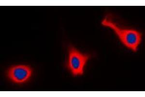 Immunofluorescent analysis of CD9 staining in HEK293T cells. (CD9 antibody  (Center))
