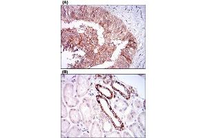 Immunohistochemical staining of human ovarian cancer tissues (A) and kidney tissues (B) with TIE1 monoclonal antibody, clone 8D12D2  at 1:200-1:1000 dilution. (TIE1 antibody  (AA 385-607))