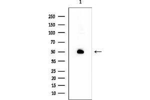 Western blot analysis of lysates from EC304 cells, using ERG Mouse Monoclonal Antibody at 1/1000 dilution.