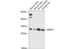 Western blot analysis of extracts of various cell lines, using MRPS2 antibody (ABIN7268584) at 1:3000 dilution. (MRPS2 antibody  (AA 1-296))