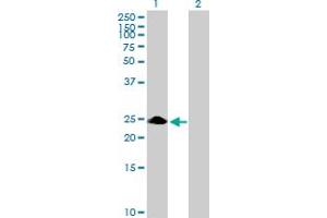 Western Blot analysis of ZNF486 expression in transfected 293T cell line by ZNF486 MaxPab polyclonal antibody. (ZNF486 antibody  (AA 1-216))
