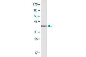 Western Blot detection against Immunogen (37. (PLEC antibody  (AA 4384-4493))