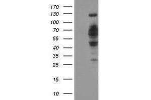 HEK293T cells were transfected with the pCMV6-ENTRY control (Left lane) or pCMV6-ENTRY DCLRE1B (Right lane) cDNA for 48 hrs and lysed. (DCLRE1B antibody  (AA 1-280))