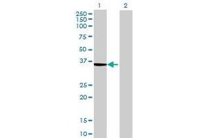 Lane 1: SLC25A3 transfected lysate ( 40 KDa) Lane 2: Non-transfected lysate. (SLC25A3 293T Cell Transient Overexpression Lysate(Denatured))