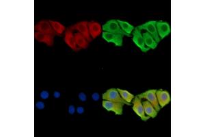 ABIN7095364 and ABIN7099421 staining Hela cells by IF/ICC. (WDR76 antibody)