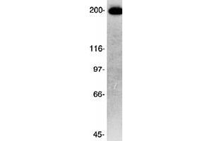 Western blot analysis of CKAP5 in human HeLa cells lysate (50 mg) using CKAP5 polyclonal antibody . (CKAP5 antibody)