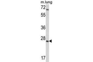 Western blot analysis of IGFBP4 Antibody (N-term) in mouse lung tissue lysates (35ug/lane). (IGFBP4 antibody  (N-Term))
