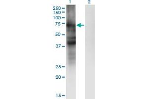 Western Blot analysis of SLC4A4 expression in transfected 293T cell line by SLC4A4 monoclonal antibody (M01), clone 1G2. (SLC4A4 antibody  (AA 1-646))