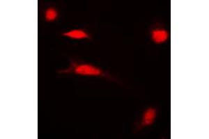 Immunofluorescent analysis of Histone H3 (AcK27) staining in HeLa cells. (Histone 3 antibody  (H3K27ac))