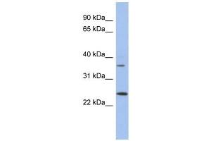 WBP2NL antibody used at 1 ug/ml to detect target protein. (WBP2NL antibody  (N-Term))