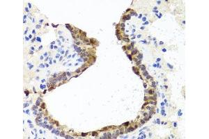 Immunohistochemistry of paraffin-embedded Rat lung using TOPBP1 Polyclonal Antibody at dilution of 1:100 (40x lens). (TOPBP1 antibody)