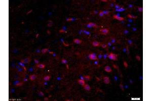 Paraformaldehyde-fixed, paraffin embedded rat brain, Antigen retrieval by boiling in sodium citrate buffer (pH6) for 15min, Block endogenous peroxidase by 3% hydrogen peroxide for 30 minutes, Blocking buffer (normal goat serum) at 37°C for 20min, Antibody incubation with 	Tau protein Polyclonal Antibody, Unconjugated  at 1:200 overnight at 4°C, followed by a conjugated secondary Goat Anti-Rabbit IgG, Cy3 conjugated-Cy3)used at 1:200 dilution for 40 minutes at 37°C. (tau antibody  (AA 681-758))