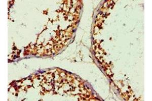 Immunohistochemistry of paraffin-embedded human testis tissue using ABIN7143676 at dilution of 1:100