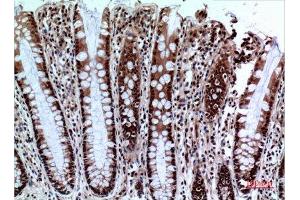 Immunohistochemistry (IHC) analysis of paraffin-embedded Human Colon, antibody was diluted at 1:100. (NKp44/NCR2 antibody  (Internal Region))